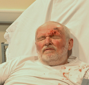 Patient assessment using a Simulated Patient Patient assessment using a Simulated Patient
