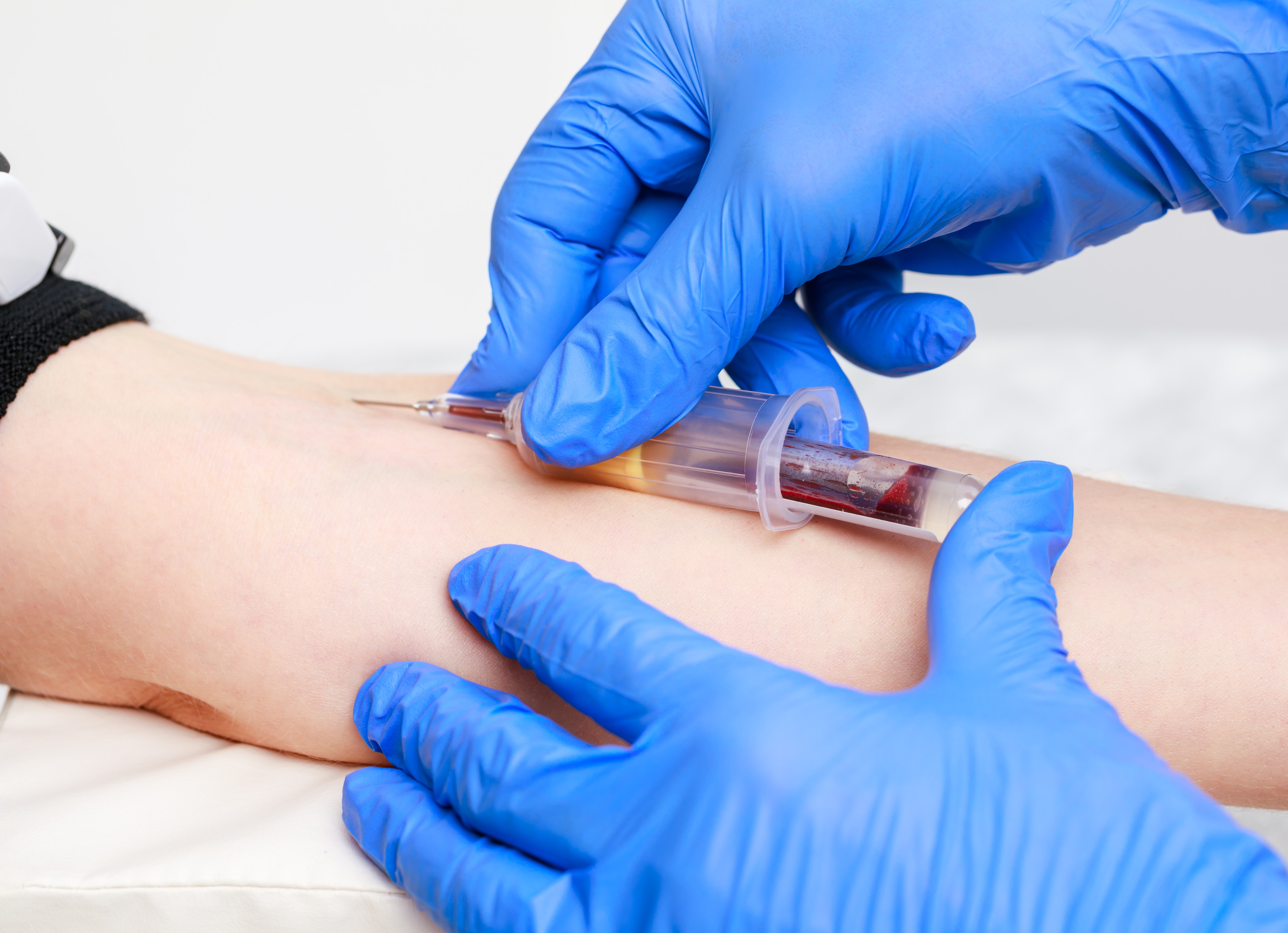 Venepuncture