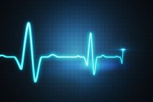 ECG Trace